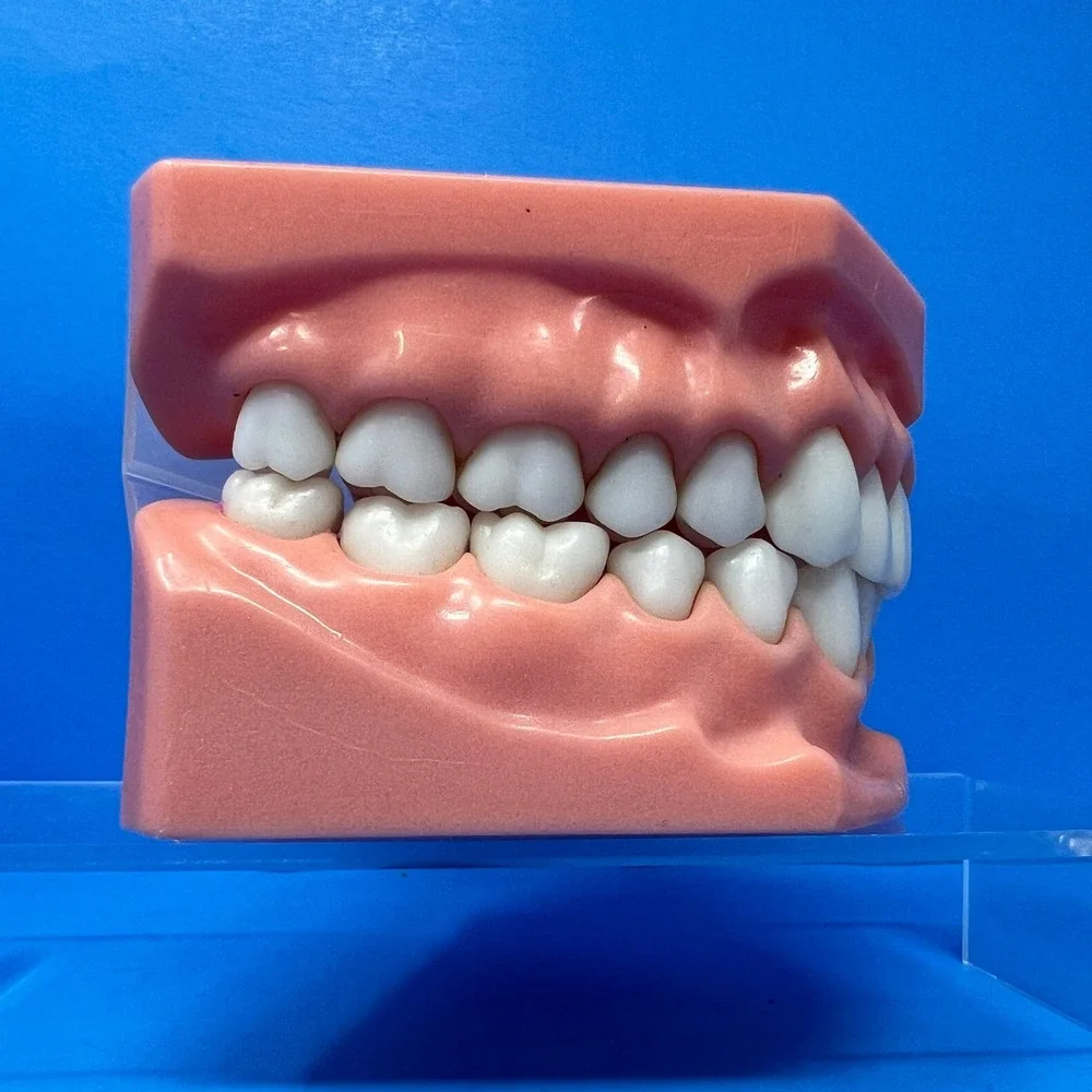 Vtg 1970's Orthodontist Dental Teaching Articulated Jaw Mouth Model Teeth Demo